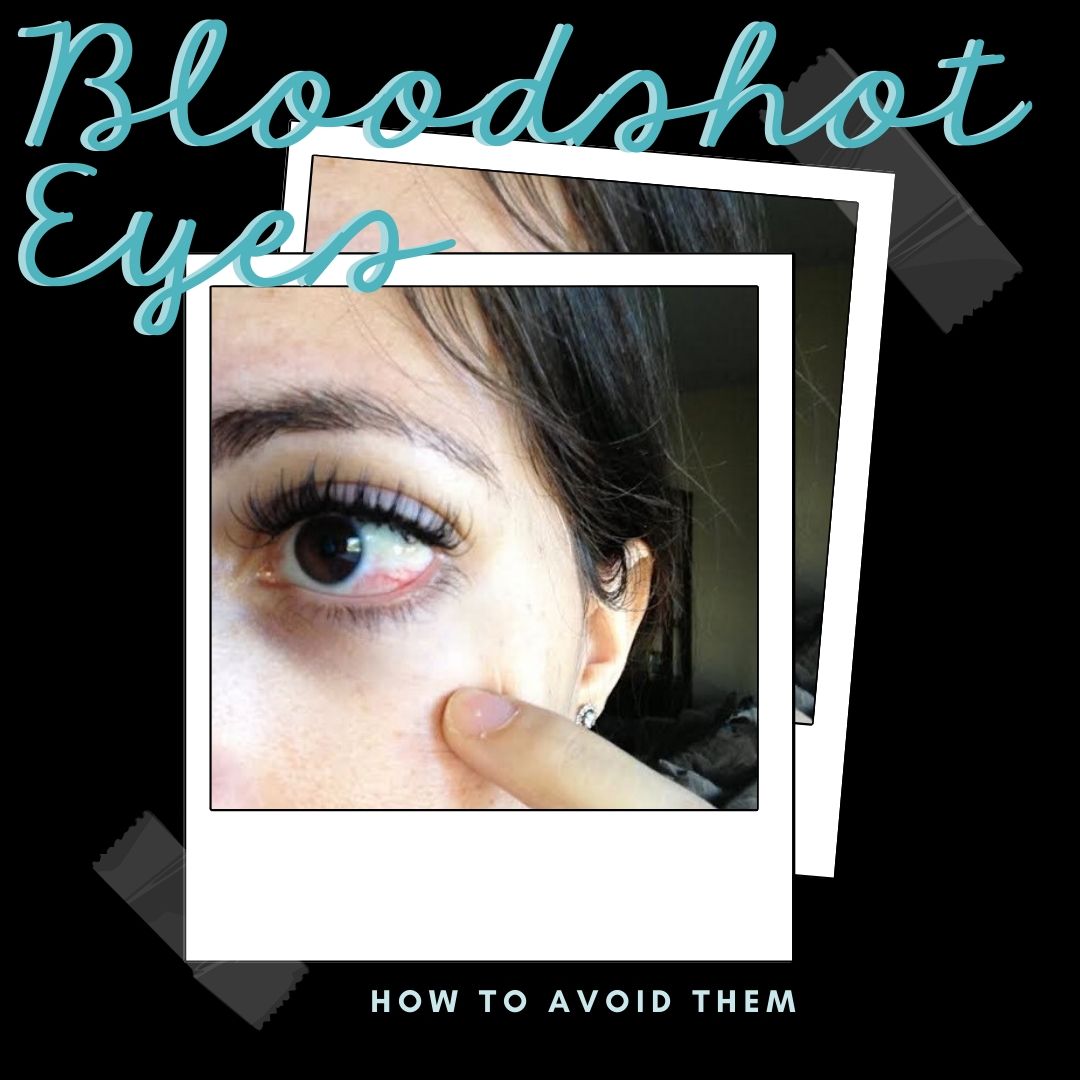 Is it Allergy or Eye Irritation Lashes By Design™