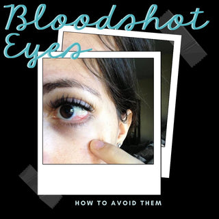 Is it Allergy or Eye Irritation